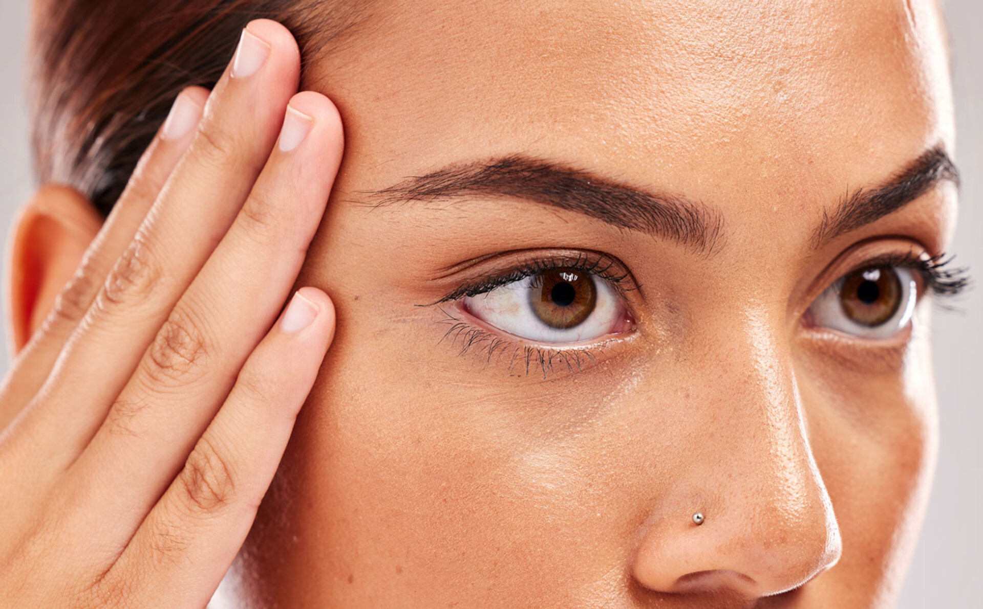 بوتاکس چشم گربه‌ای در تهران با تخفیف ویژه | تجربه لیفت ظریف در کلینیک زیبایی زیباریس پیروزی